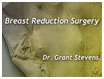About Breast Reduction Surgery
